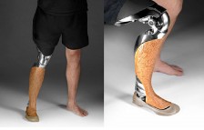 Inoventive 3D Printed prosthetic