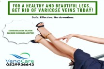 Spider Veins Treatments Dubai