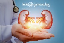 Top 10 Kidney Transplant Centers In India