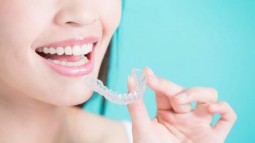 What should you know about clear retainers?