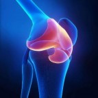 Knee Replacement in Singapore: A Guide to the Procedure, Cost, and Recovery