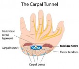 Easing Hand Pain with Carpal Tunnel Syndrome Treatment: Options and Solutions
