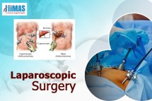 Laparoscopic Surgery Basavanagudi,Jayanagar,Bangalore