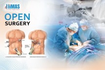 Open Surgery Jayanagar,Bangalore,Banashankari,Basavanagudi-Himashospital