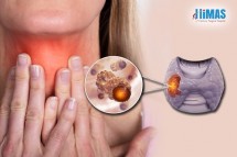 Thyroid Cancer Treatment Basavanagudi,Banashankari,Jayanagar,Bangalore-Himashospital