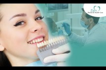 Best Cosmetic Dentist Service In Sarjapur Road, Bangalore – Zen Dental Care