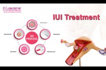 Affordable IUI Treatment in Bangalore - Low Cost IVF Treatment