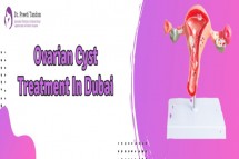 Ovarian Cyst Removal In Dubai