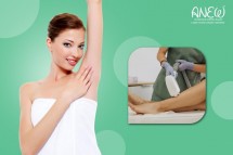 Affordable Laser Treatment in Bangalore at Anew Cosmetic Clinic