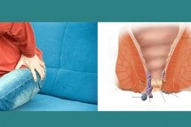 Best Piles Treatment in Bangalore