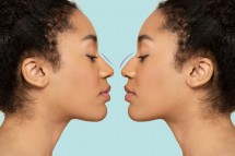 Rhinoplasty Swelling Stages | Expectation After Rhinoplasty