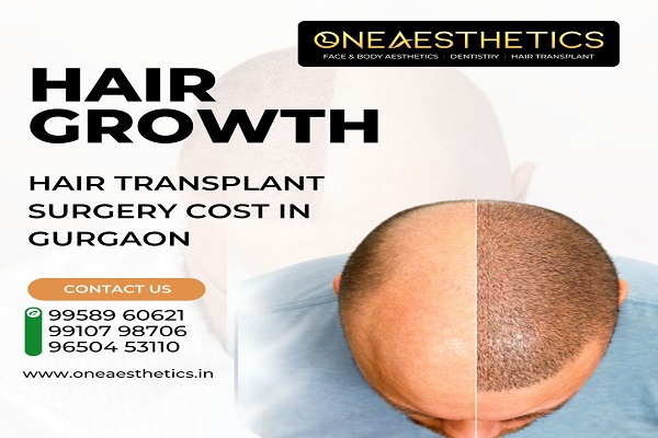 Hair Transplant Surgery Cost In Gurgaon