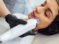 Restore Youthful Skin with Advanced Morpheus8 Treatments