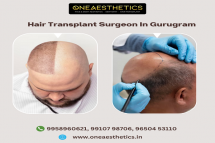 Hair Transplant Surgery in Gurgaon