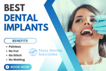 Trisa Dental Solutions : Best Dental Implants Clinic in Mumbai