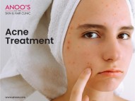 Advanced PRP Treatment for Hair growth at Anoos