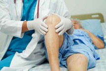 Trusted Knee Surgeon in Cheshire – Advanced Knee Treatments