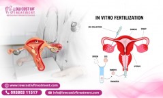 Breaking Down the Cost of IVF Treatment: What to Expect Financially