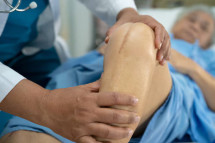 Top Knee Surgeon in Knutsford – Expert Care at The Knee Clinic