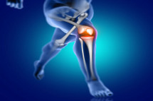 Top Knee Surgeon in Wirral – The Knee Clinic Manchester