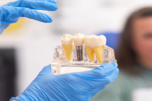 Top Clinic for Dental Replacement in Dubai – Book Now