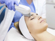 IPL (Intense Pulsed Light) - Mid Florida Dermatology & Plastic Surgery