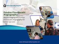 Best Fundus Angiography Care for Eye Health