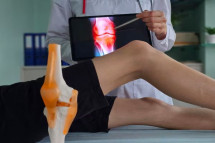 Patellofemoral Instability Treatment in Manchester | Knee Specialist