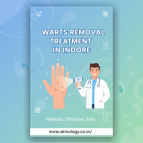 What Causes Warts and How They Spread on Skin Easily