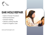 Ear Lobe Repair in Delhi: What Residents Should Know