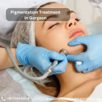 Pigmentation Treatment in Gurgaon for Clear & Even Skin
