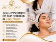 Best Dermatologist for Scar Reduction in Vijay Nagar