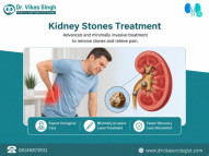 How Kidney Stone Reports Help Plan the Right Treatment