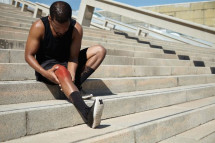 MPFL Tear vs. Sprain: Diagnosis, Symptoms & Treatment