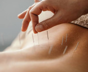 Pain Management Acupuncture in NYC | Back, Neck & Sciatica Relief